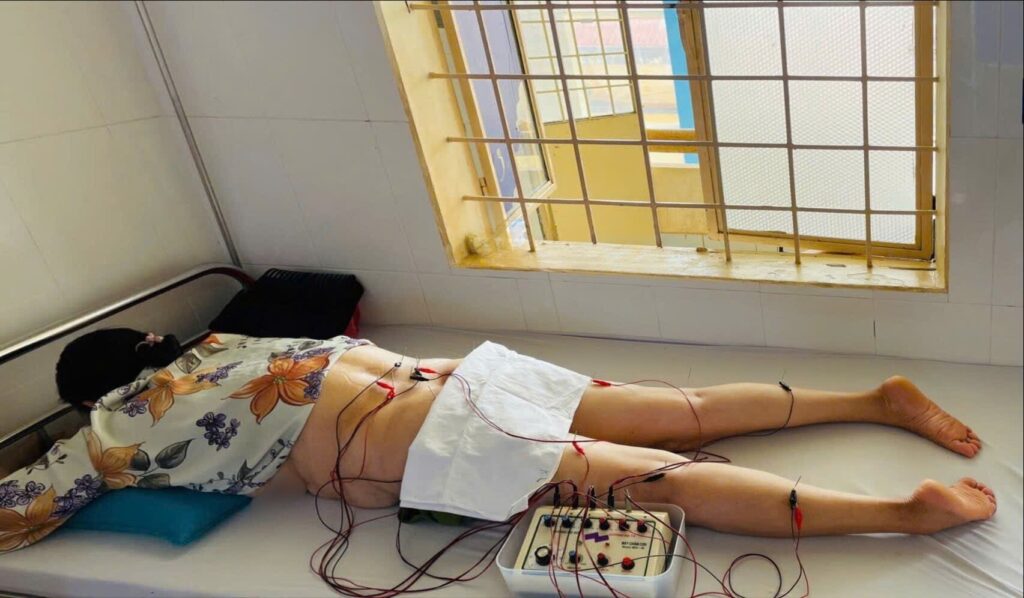 Đau thần kinh tọa