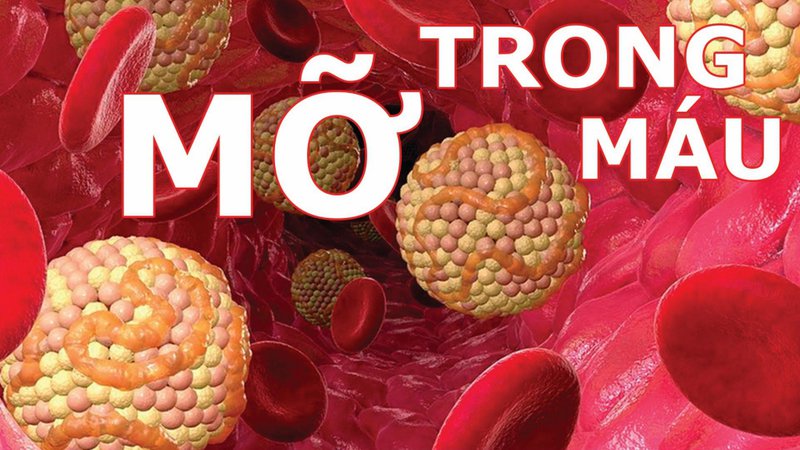 XÉT NGHIỆM MỠ MÁU