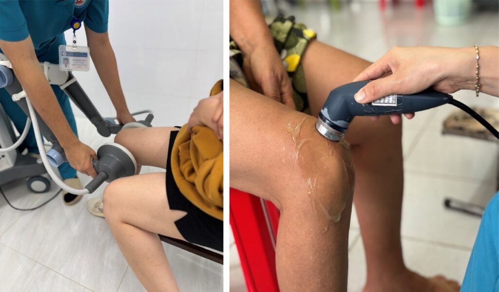ĐIỀU TRỊ CỨNG KHỚP