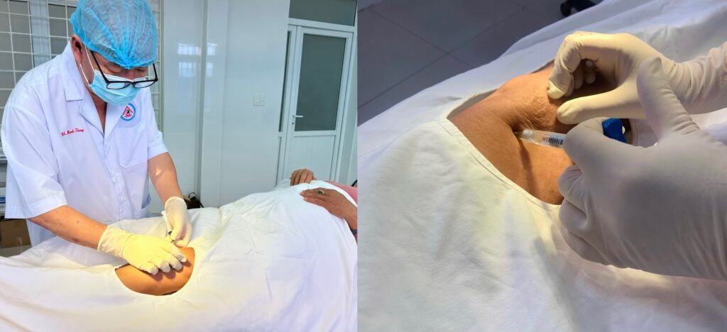 ĐIỀU TRỊ THOÁI HÓA KHỚP