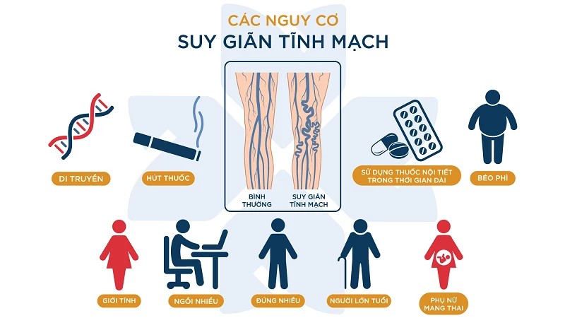 Suy giãn tĩnh mạch