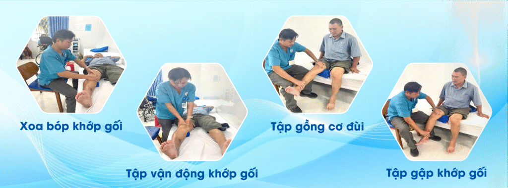 Phục hồi chức năng sau đứt dây chằng